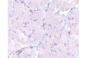 Immunohistochemical staining of human skeletal muscle tissue with 10 ug/mL SCARB2 polyclonal antibody . (SCARB2 anticorps  (C-Term))
