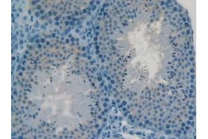 DAB staining on IHC-P; Samples: Mouse Testis Tissue (C2CD3 anticorps  (AA 2051-2323))