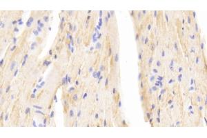 Detection of b2M in Mouse Cardiac Muscle Tissue using Polyclonal Antibody to Beta-2-Microglobulin (b2M) (beta-2 Microglobulin anticorps  (AA 22-119))