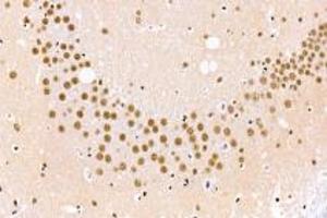 Immunohistochemistry analysis of paraffin-embedded mouse cerebral infarction using BAAT1 (ABIN7073502) at dilution of 1: 1000
