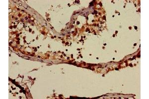 Immunohistochemistry of paraffin-embedded human testis tissue using ABIN7144908 at dilution of 1:100 (ABCC9 anticorps  (AA 560-669))