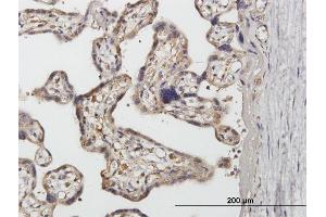 Immunoperoxidase of purified MaxPab antibody to SNX1 on formalin-fixed paraffin-embedded human placenta.