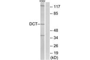 Western blot analysis of extracts from K562 cells, using DCT Antibody. (DCT anticorps  (AA 51-100))