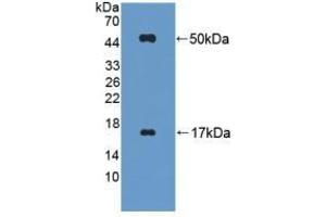 Detection of Recombinant FGL2, Mouse using Polyclonal Antibody to Fibrinogen Like Protein 2 (FGL2) (FGL2 anticorps  (AA 20-432))