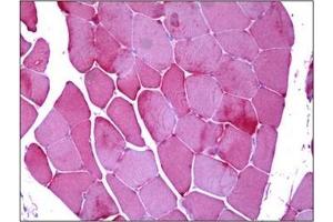 Immunohistochemistry (IHC) image for anti-Phosphorylase, Glycogen, Muscle (PYGM) antibody (ABIN952549)