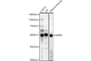 Western blot analysis of extracts of various cell lines, using G6PD antibody (ABIN3022094, ABIN3022095, ABIN3022096 and ABIN6218601) at 1:1000 dilution. (Glucose-6-Phosphate Dehydrogenase anticorps  (AA 246-545))