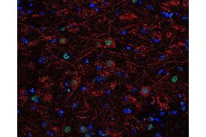 Indirect immunolabeling of PFA fixed, paraffin embedded mouse brain section with guinea pig anti-Tbr 1 (dilution 1 : 500; green) and rabbit anti-neurofilament H (, dilution 1 : 500; red). (TBR1 anticorps  (AA 128-145))