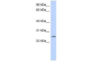 anti-Na+/K+ Transporting ATPase Interacting 4 (NKAIN4) (Middle Region) antibody