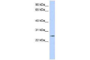 NKAIN4 antibody used at 1 ug/ml to detect target protein. (NKAIN4 anticorps  (Middle Region))