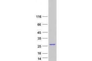 Validation with Western Blot (C5orf24 Protein (Transcript Variant 1) (Myc-DYKDDDDK Tag))