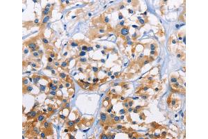 Immunohistochemistry (IHC) image for anti-Capping Protein (Actin Filament) Muscle Z-Line, alpha 3 (CAPZA3) antibody (ABIN2423053) (CAPZA3 anticorps)