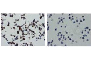 Immunohistochemistry (IHC) image for anti-Tumor Necrosis Factor (Ligand) Superfamily, Member 13b (TNFSF13B) antibody (ABIN1449224) (BAFF anticorps)