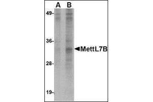Western blot analysis of MettL7B in Jurkat lysate with this product at (A) 2 and (B) 4 μg/ml. (METTL7B anticorps  (N-Term))