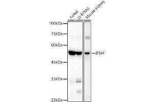 Western blot analysis of extracts of various cell lines, using IFI44 antibody (ABIN6135120, ABIN6142168, ABIN6142169 and ABIN6224213) at 1:1000 dilution. (IFI44 anticorps)