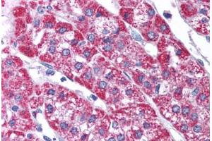 Human Adrenal (formalin-fixed, paraffin-embedded) stained with KCNH6 antibody ABIN214783 at 5 ug/ml followed by biotinylated goat anti-rabbit IgG secondary antibody ABIN481713, alkaline phosphatase-streptavidin and chromogen.