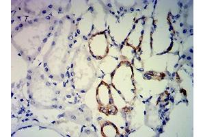 Immunohistochemical analysis of paraffin-embedded kidney tissues using ERCC1 mouse mAb with DAB staining.