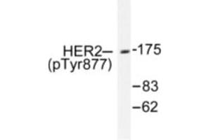 Image no. 1 for anti-Receptor tyrosine-protein kinase erbB-2 (ErbB2/Her2) (pTyr877) antibody (ABIN318038) (ErbB2/Her2 anticorps  (pTyr877))