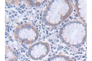 Detection of GLTP in Human Stomach Tissue using Polyclonal Antibody to Glycolipid Transfer Protein (GLTP)