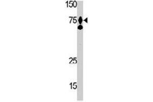 The HGF polyclonal antibody  is used in Western blot to detect HGF in Ramos cell lysate. (HGF anticorps  (AA 521-554))