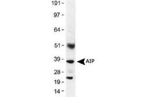 Western blot analysis of AIP in mouse lung lysates (30 ug) using AIP monoclonal antibody, clone 35-2  at 1 : 500 with a 1 second exposure. (AIP anticorps)