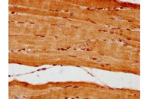 IHC image of ABIN7161836 diluted at 1:300 and staining in paraffin-embedded human skeletal muscle tissue performed on a Leica BondTM system. (NUP62 anticorps  (AA 173-522))