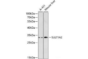 Western blot analysis of extracts of various cell lines using SULT1A2 Polyclonal Antibody at dilution of 1:3000.