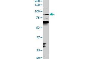 PCAF monoclonal antibody (M02), clone 1H2.