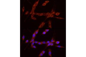 anti-Glial Cell Line Derived Neurotrophic Factor (GDNF) (AA 109-211) antibody