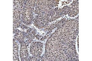 IHC analysis of hnRNP L/HNRNPL using anti-hnRNP L/HNRNPL antibody (ABIN7600130). (HNRNPL anticorps  (AA 152-569))