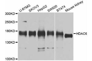 Western blot analysis of extracts of various cell lines, using HDAC6 antibody. (HDAC6 anticorps)
