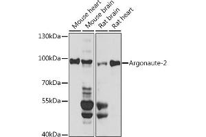 Western blot analysis of extracts of various cell lines, using Argonaute-2 antibody (ABIN6133693, ABIN6140045, ABIN6140047 and ABIN6221669) at 1:1000 dilution.