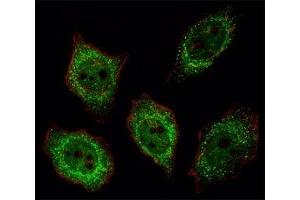 Fluorescent image of U251 cell stained with PGP 9.