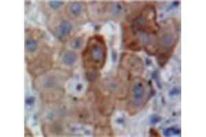 Used in DAB staining on fromalin fixed paraffin-embedded Liver tissue (APOB anticorps  (AA 3365-3548))