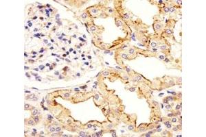 anti-Activating Transcription Factor 6 beta (ATF6B) (AA 560-589) antibody