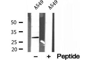 Western blot analysis of extracts of A549 cells, using RAB3D antibody. (RAB3D anticorps  (Internal Region))