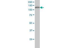 HDAC5 monoclonal antibody (M01), clone 4G2 Western Blot analysis of HDAC5 expression in COLO 320 HSR