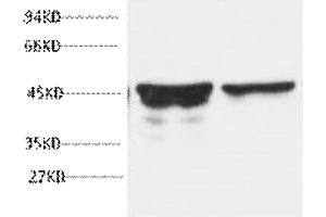 Western blot analysis of rat brain tissue, diluted at 1:5000. (GFAP anticorps)