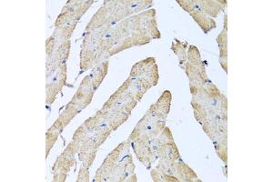 Immunohistochemistry of paraffin-embedded mouse heart using ATAD3B antibody (ABIN5974542) at dilution of 1/100 (40x lens). (ATAD3B anticorps)