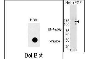 (LEFT)Dot blot analysis of Phospho-EGFR- polyclonal antibody (ABIN1881283 and ABIN2839662) on nitrocellulose membrane. (EGFR anticorps  (pTyr1069))