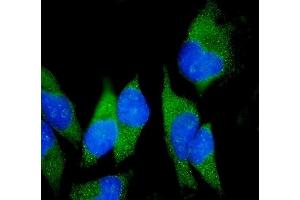 IF analysis of Claudin18/CLDN18 using anti-Claudin18/CLDN18 antibody (ABIN7601257). (Claudin 18 anticorps  (AA 31-261))