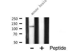 Western blot analysis of CARD6 expression in Mouse brain lysate