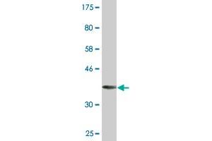 Western Blot detection against Immunogen (36. (LMTK3 anticorps  (AA 1151-1250))