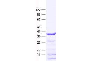 Validation with Western Blot