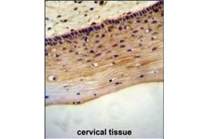 LRC18 antibody (C-term) (ABIN654486 and ABIN2844221) immunohistochemistry analysis in formalin fixed and paraffin embedded human cervical tissue followed by peroxidase conjugation of the secondary antibody and DAB staining.