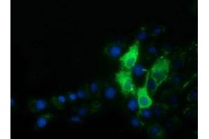 Image no. 3 for anti-alpha-Fetoprotein (AFP) antibody (ABIN1496485)