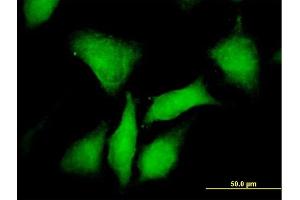 Immunofluorescence of purified MaxPab antibody to PRKAR1B on HeLa cell.