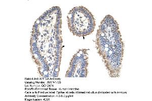 Rabbit Anti-KRT2AAntibody  Paraffin Embedded Tissue: Human Intestine Cellular Data: Epithelial cells of intestinal villas Antibody Concentration: 4.