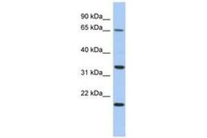Image no. 1 for anti-Tumor Protein P63 Regulated 1 (TPRG1) (AA 35-84) antibody (ABIN6743909)