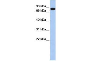 WB Suggested Anti-APEH Antibody Titration: 0. (APEH anticorps  (N-Term))