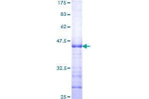Image no. 1 for N-Myc Proto-Oncogene Protein (MYCN) (AA 1-100) protein (GST tag) (ABIN1311730)